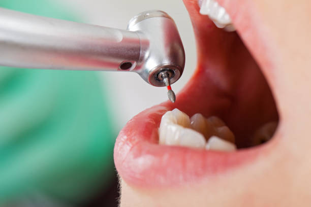 Best Weekend Emergency Dentist in Wofford Heights, CA